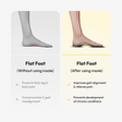 Frido Arch Support Insoles Rigid + Semi Rigid Combo