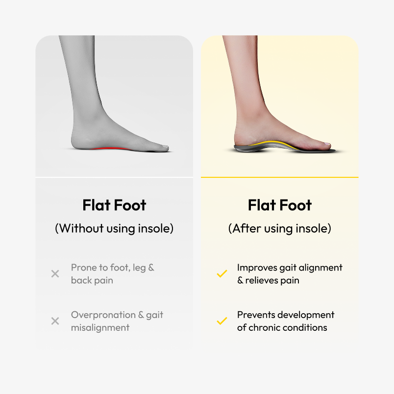 Frido Arch Support Insoles Rigid + Semi Rigid Combo