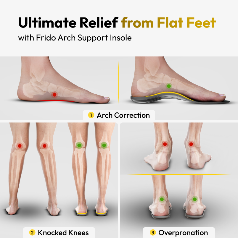Frido Arch Support Insoles Rigid + Semi Rigid Combo