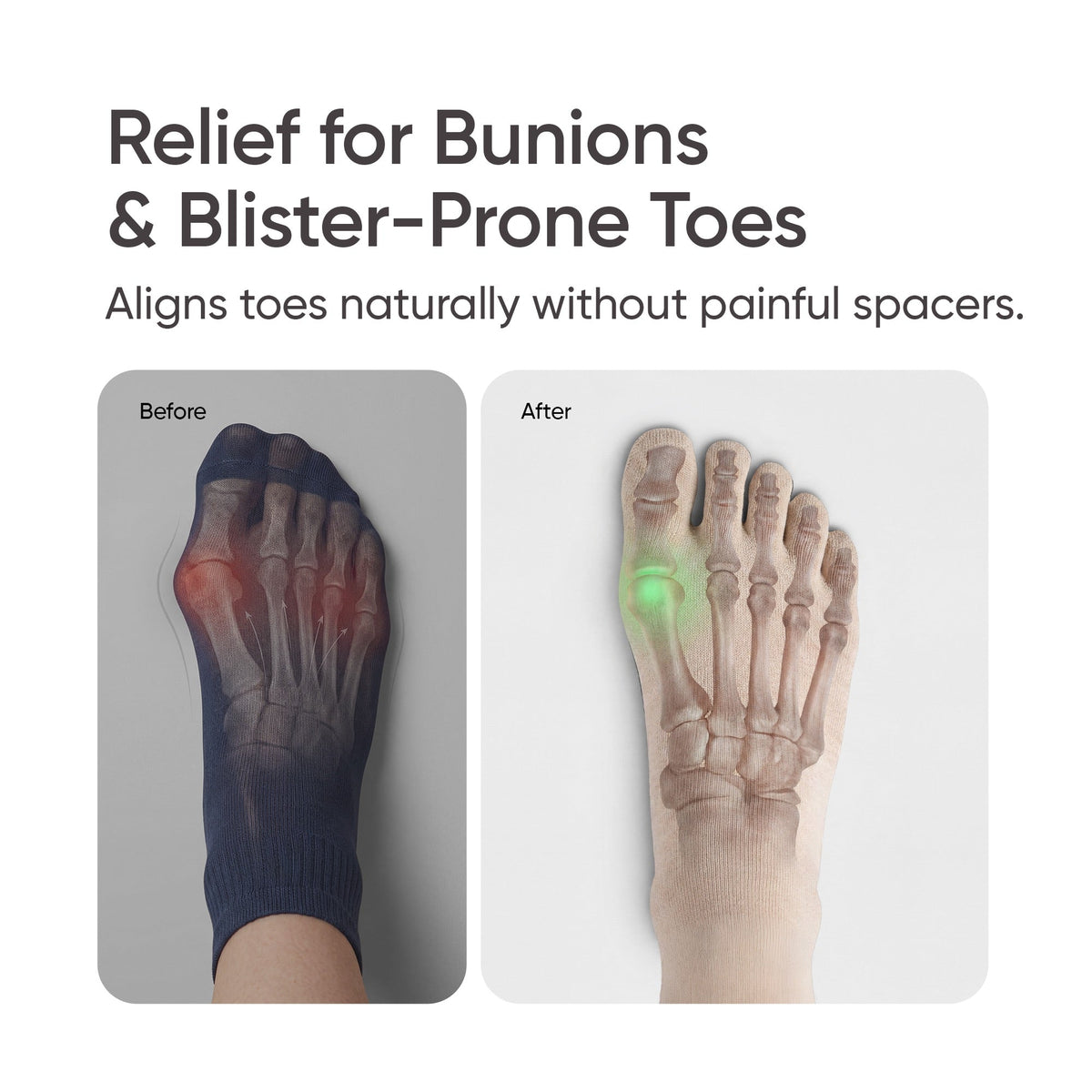 Frido Five Toe Socks - Solid
