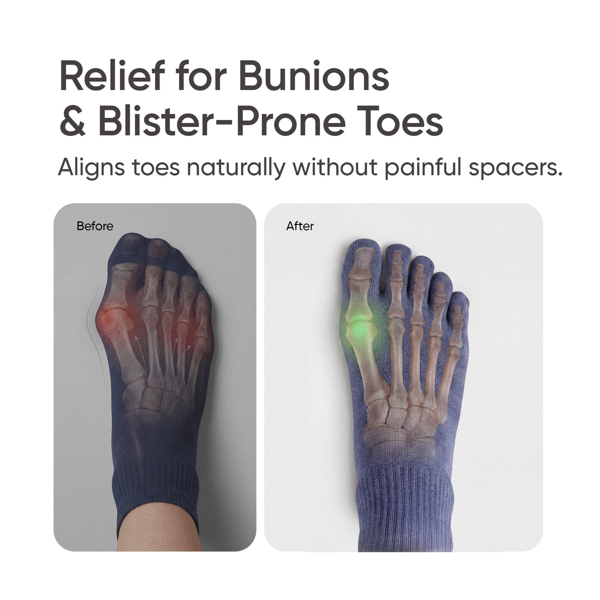 Frido Five Toe Socks - Solid