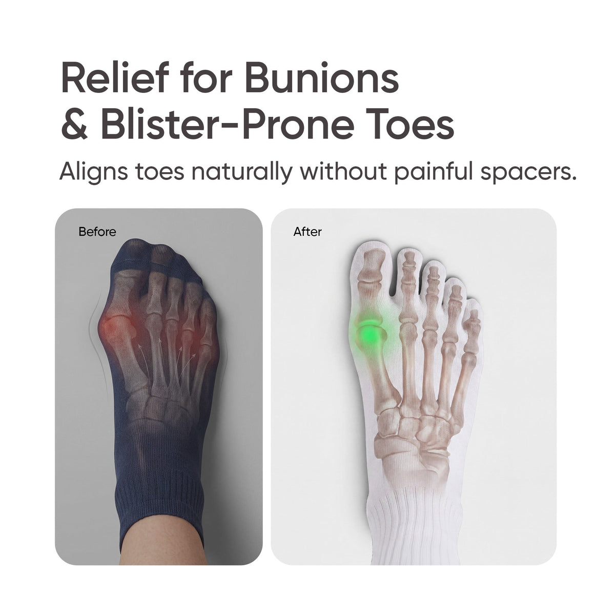 Frido Five Toe Socks - Solid
