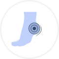 Instant Relief From Heel Pain