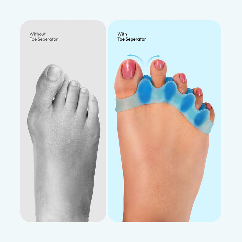 Designed to Prevent Toe Crowding & Overlap for Natural Alignment